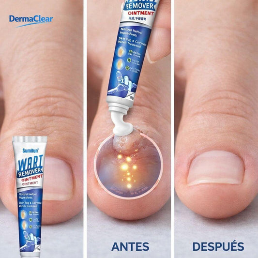DERMA CLEAR - ELIMINA VERRUGAS